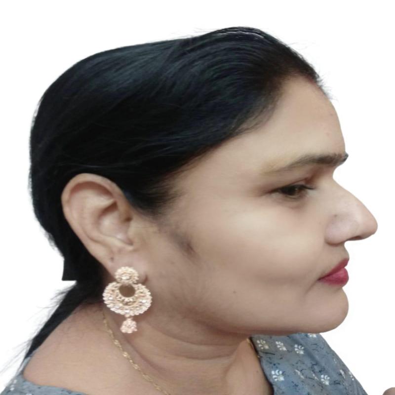 Golden Earrings - Image 2