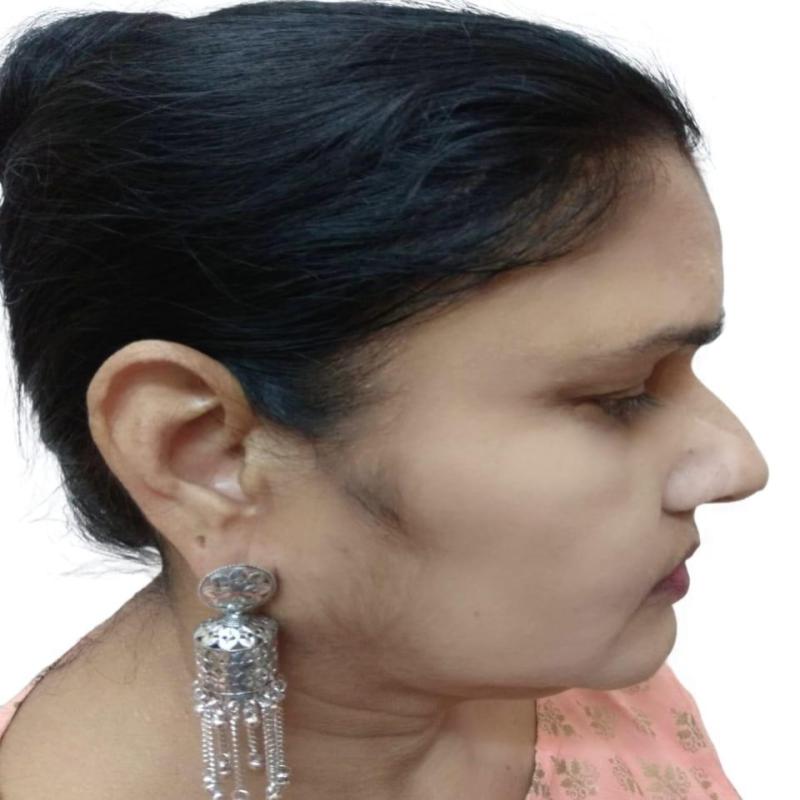 Junk Earrings - Image 2