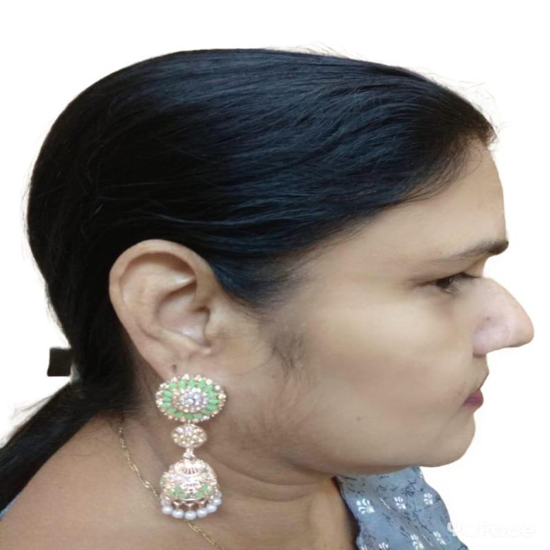 Golden Earrings - Image 2